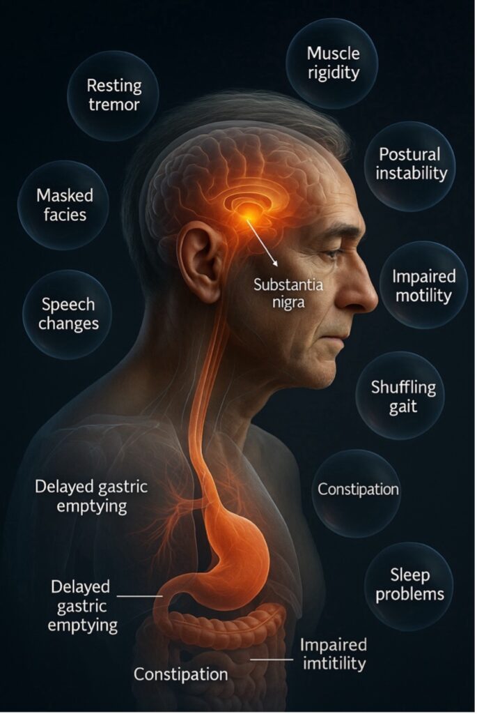 Kite, Waves and Hope: How Water Sports and a Mediterranean Lifestyle Improve Life for People with Parkinson’s Disease